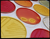 Bacteriology petri dishes containing samples