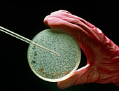 Petri dish with bacterial colonies being pipetted
