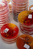 Stacks of petri dish faecal bacterial cultures