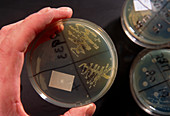 Hand holds urinary bacterial culture in petri dish