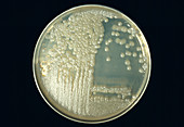 Cultured anthrax bacteria