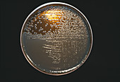 Cultured E. coli bacteria