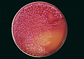 Cultured pneumonia bacteria