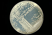 Cultured Cryptococcus fungus