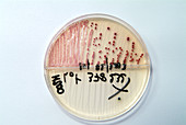 Staphylococcus bacterial culture