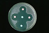 Anthrax antibiotic research