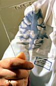 Slide of sectioned human brain in CJD disease test