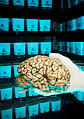 Human brain in brain bank