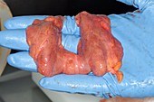 Thyroid glands,post-mortem