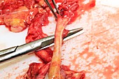Neck artery and vagus nerve,post-mortem