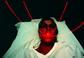 Red argon laser used to treat cancer of throat