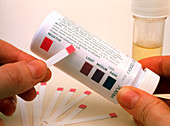 Doctor with negative (normal) Clinistix urine test