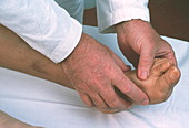 Foot examination