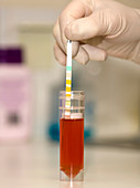 Testing for blood in urine