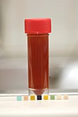 Testing for blood in a urine sample