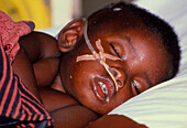 Tanzanian child suffering from malaria