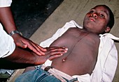 Health worker examining boy for schistosomiasis