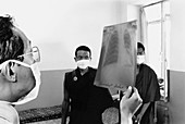 Doctor in tuberculosis ward in India