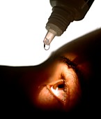 Close-up of a woman applying eye drops to her eye