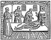 15th-century autopsy