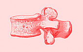 Spinal vertebra