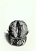 Engraving of historical brain dissection