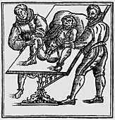 16th century surgical technique of Ambroise Pare