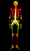 Coloured gamma scan of the human skeleton