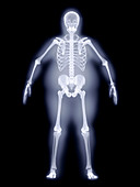 Obese man,X-ray artwork