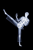 Kung fu kick,X-ray artwork