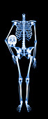 Headless skeleton