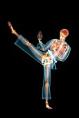 Martial arts kick,X-ray artwork