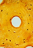 Light micrograph of normal human compact bone