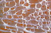 Close-up of normal human spongy bone
