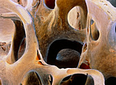 Coloured SEM of femoral spongy bone