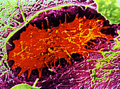 SEM of an osteoblast cell