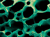 Coloured SEM of human spongy bone