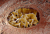 Bone lacuna,SEM