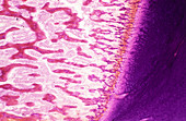 Bone growth,light micrograph