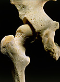 Photograph of the bones of the human hip joint