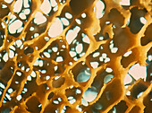 Macrophoto of human spongy bone