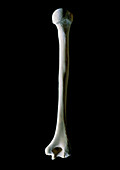 Photo of the human right humerus