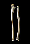 Bones of the left forearm in anterior aspect