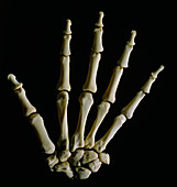 Bones of the wrist joint and hand