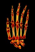 Coloured X-ray of a normal human hand
