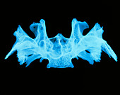 X-ray image of a human sphenoid bone