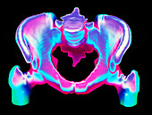 3-D CT scan of bones of a normal adult pelvis