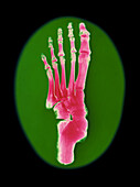Coloured X-ray of bones in a human foot (top view)