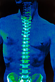 Coloured 3-D CT scan of the human spine