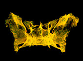 Coloured X-ray of human sphenoid bone